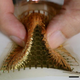 Illustration for article titled Sensors Thinner Than Plastic Wrap Could Detect Breast Cancer